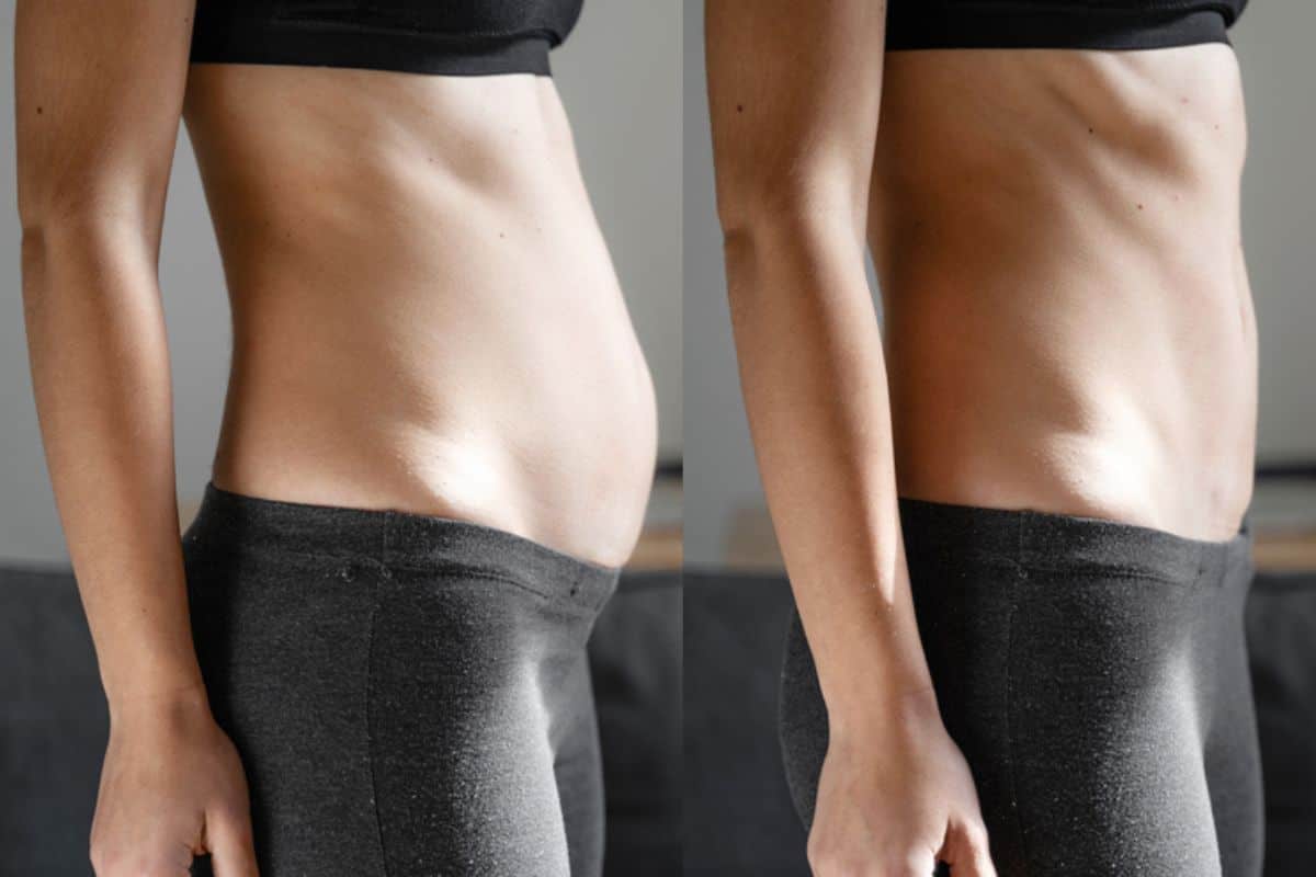 Post-Pregnancy: What Happens to Your Abdominal Muscles After Birth Temple Mills