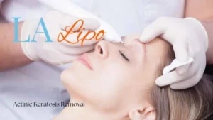 Woman receiving Actinic Keratosis Removal Treatment Temple Mills