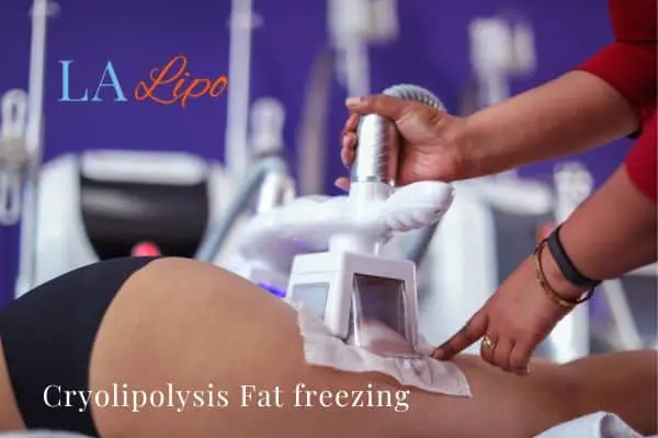 women getting fat freezing Temple Mills