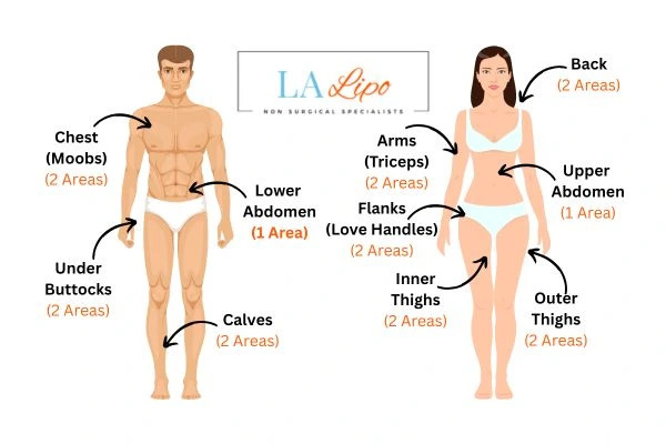 LA LIPO Cryolipolysis Areas Temple Mills