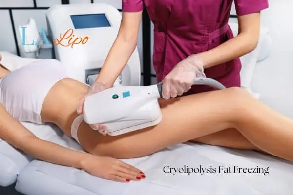 Woman receiving coolsculpting Temple Mills treatment on her thighs