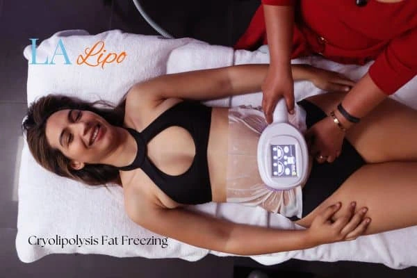 woman getting cryolipolysis Temple Mills