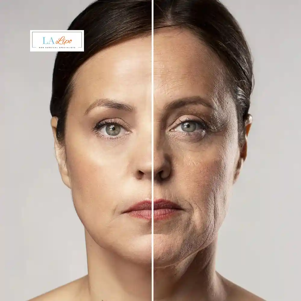 How Can You Tell If Non-Surgical Skin Tightening Is Right for You Temple Mills?