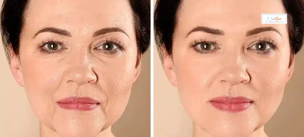 How Long Does It Take to See Results and How Long Do They Last Temple Mills?