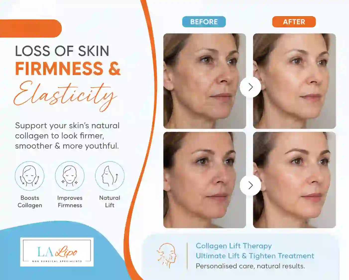 Sign #7: Loss of Skin Firmness and Elasticity Temple Mills